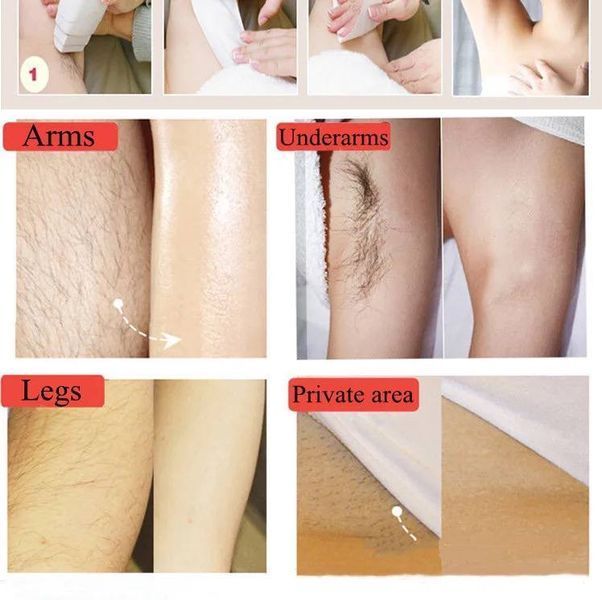 Папір для депіляції Depilatory Paper у смужках (100 шт) 001086 фото